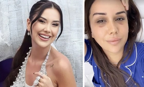 Dilan Polat ve Engin Polat çiftine gözaltı! Uyuşturmaya özendirme suçundan